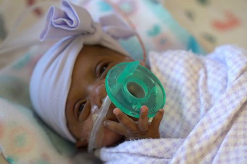 کوچکترین نوزاد دنیا پس از 5 ماه مراقبت روانه خانه شد